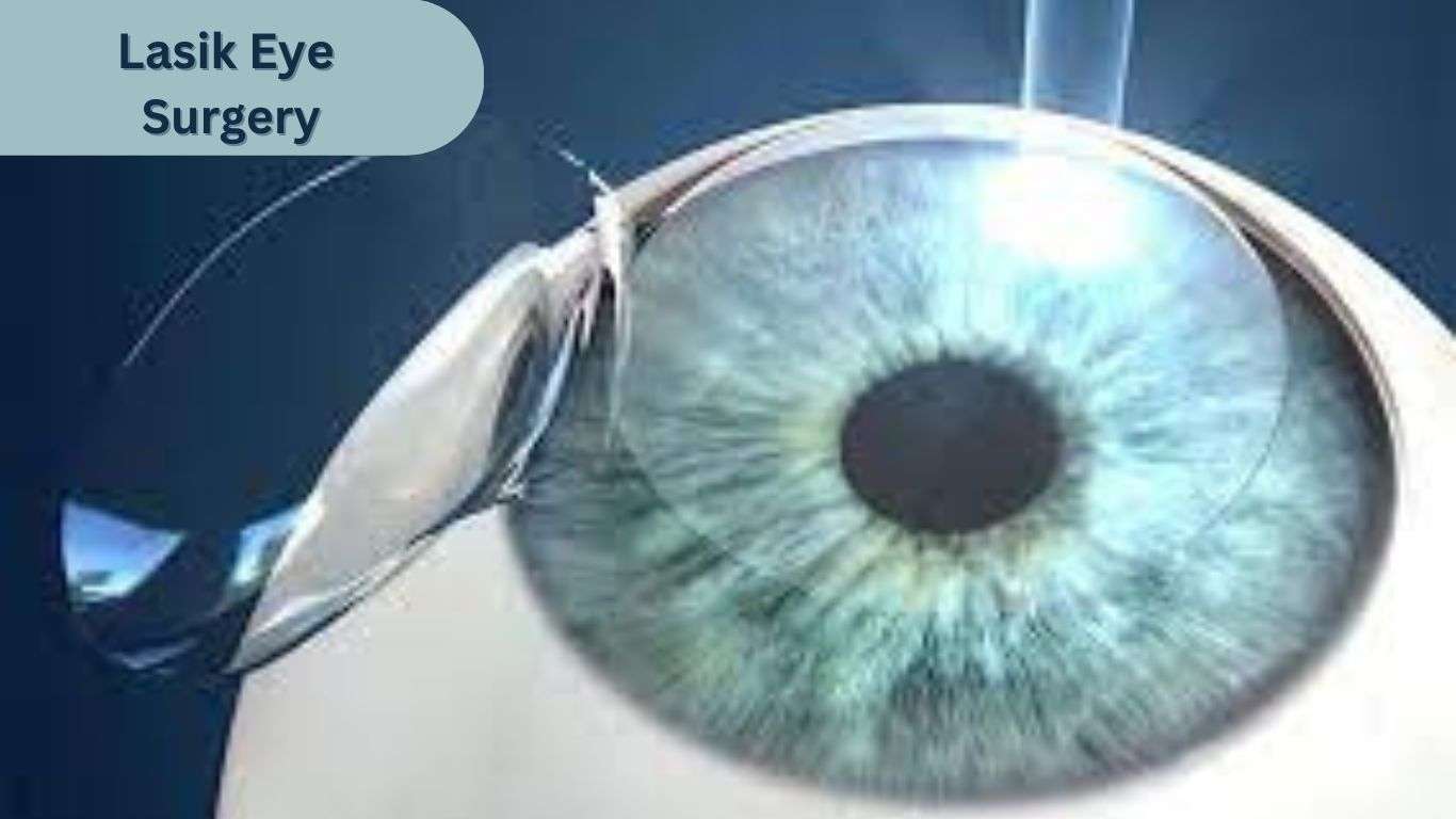 Lasik surgery of the eye 