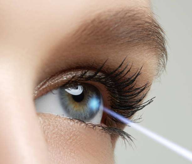 eye surgery for thin cornea