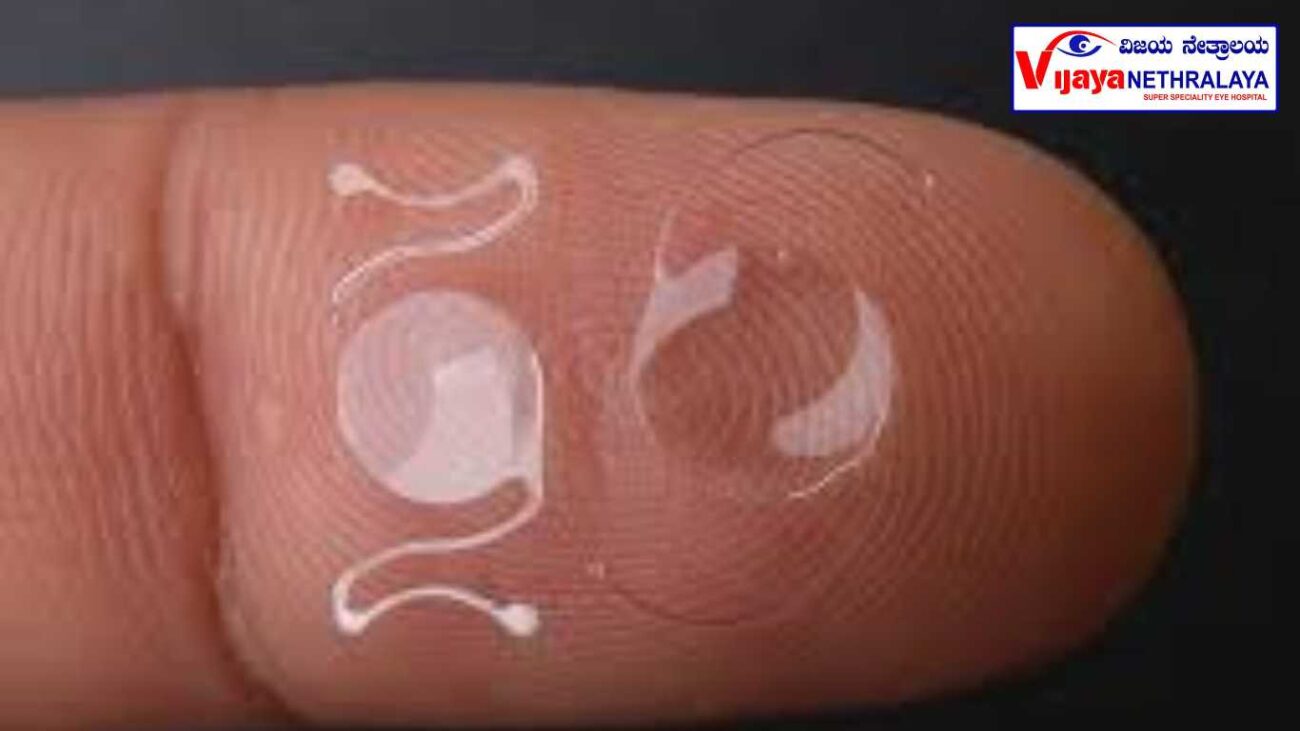 contact lens of visian ICL in one finger of human being 
