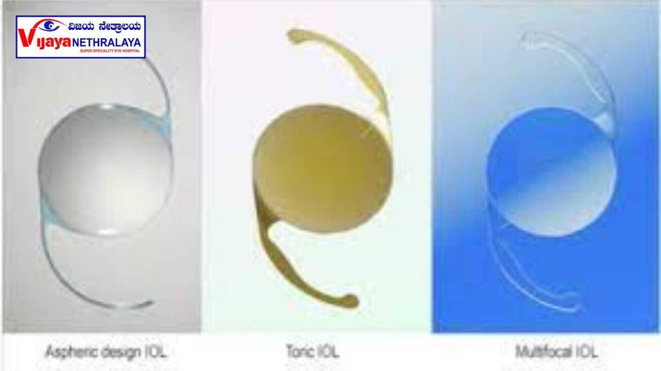 Types of cataract lenses 