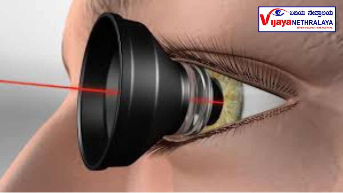 Retina Treatment by Laser 