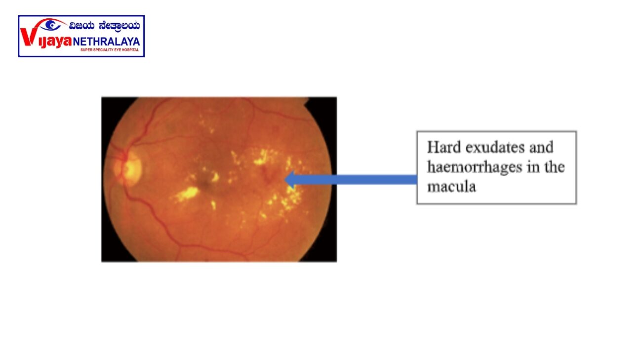 FUNDUS PHOTOS