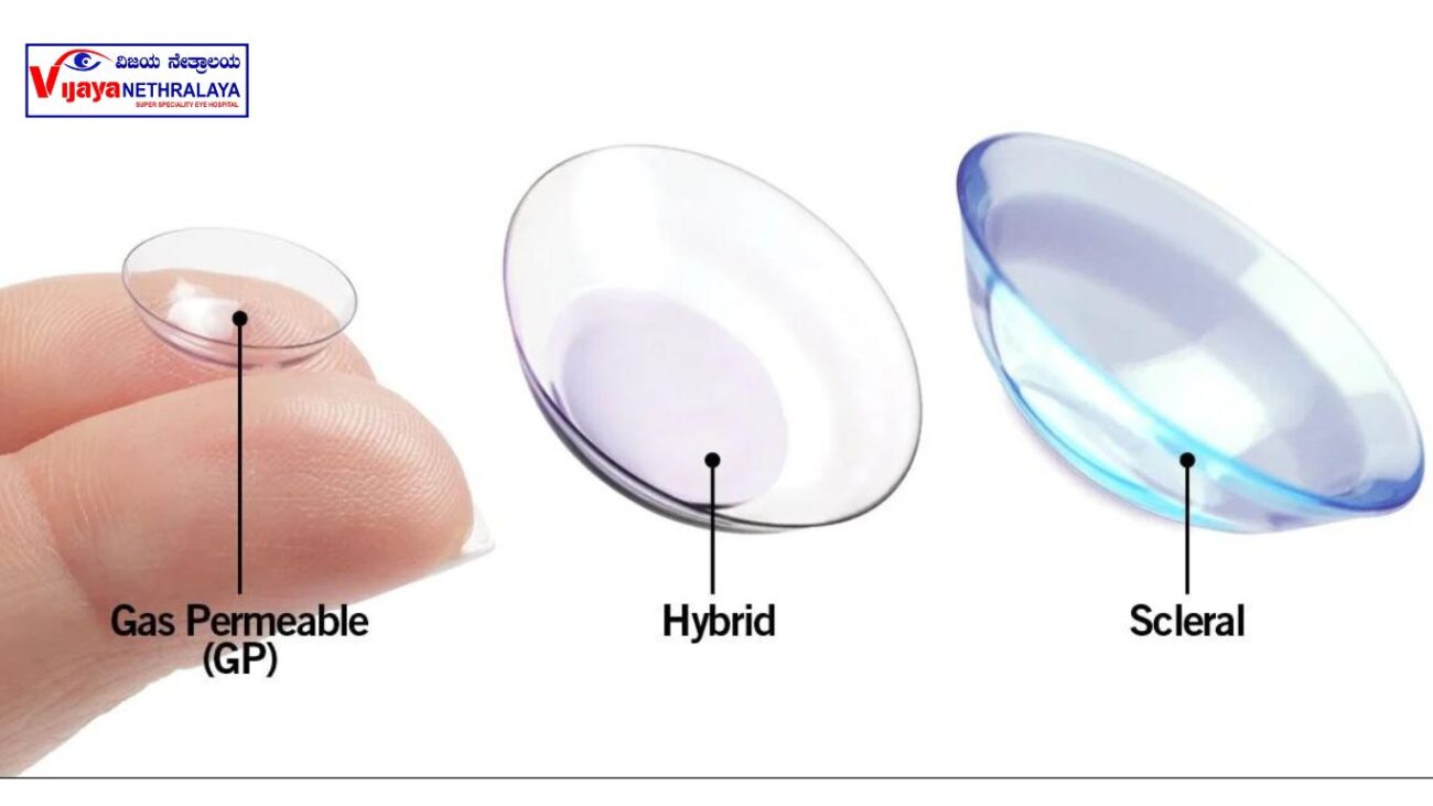 Gas-Permeable (GP) Lenses