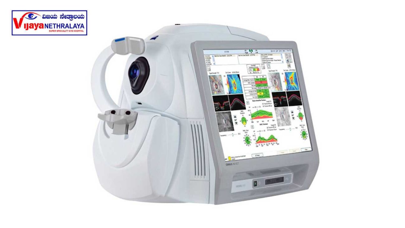 oct test for glaucoma 