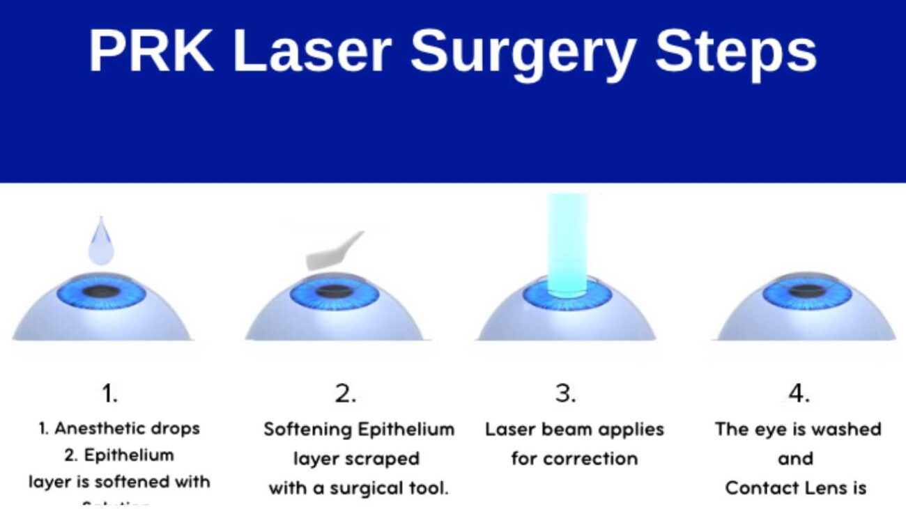 Prk Laser Surgery