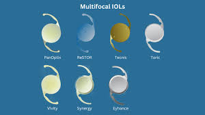 Multifocal and Monofocal Lenses