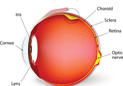 retinal detachment