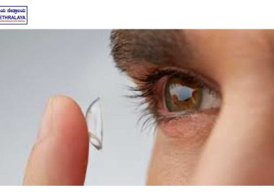 permanent-contact-lens