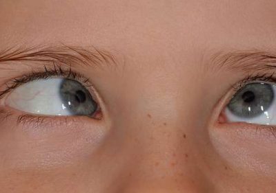 showing children her squint eye