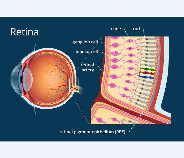 Retina - Vijaya Nethralaya