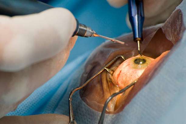pneumatic retinopexy injection