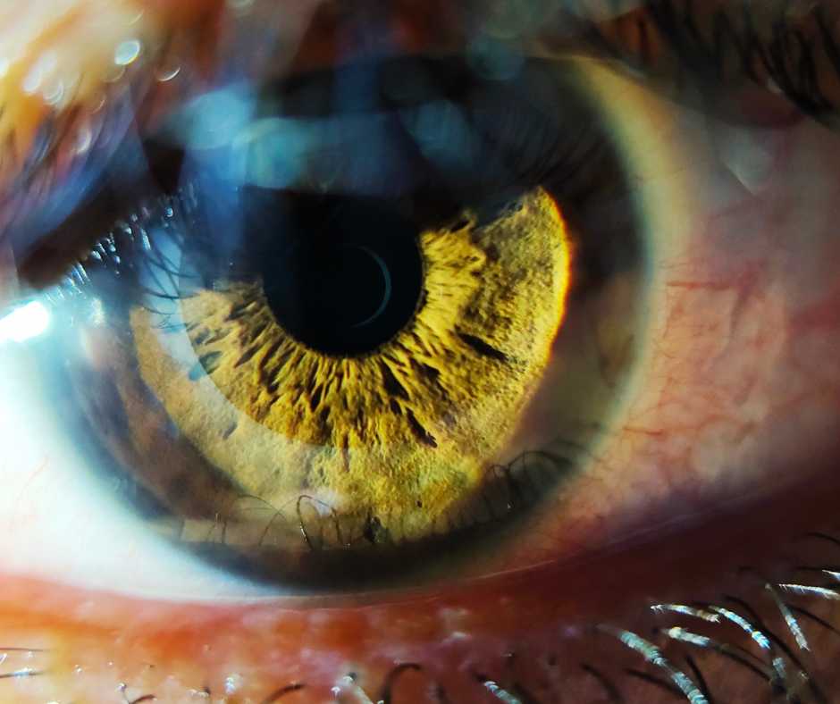 close image of eye picture