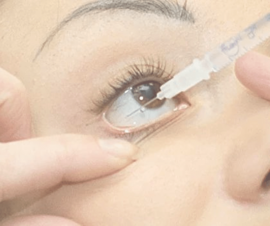 Learn about Avastin injection, its uses, and how it can improve vision.