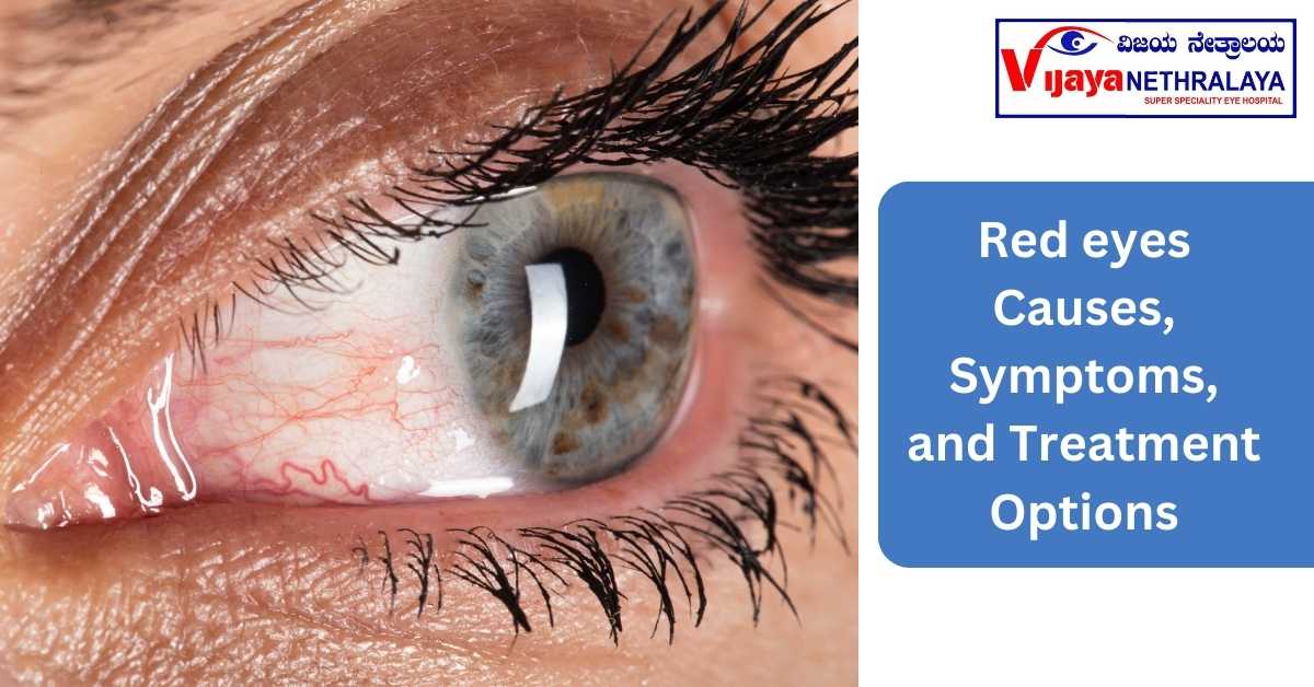 Red eyes Causes, Symptoms, and Treatment Options
