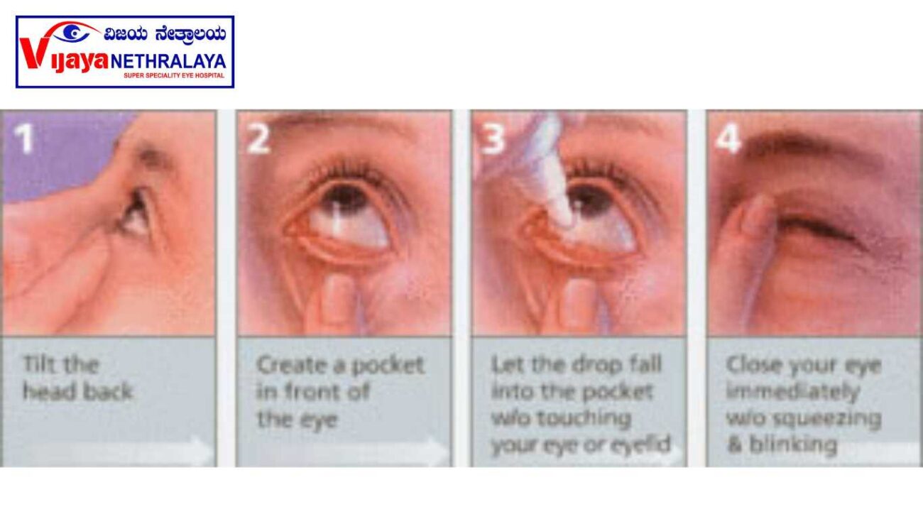 Tips for Using Eye Drops
