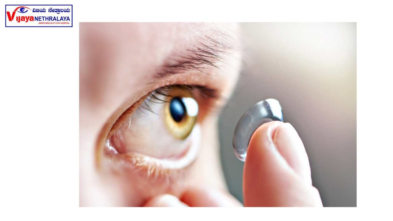 permanent contact lenses