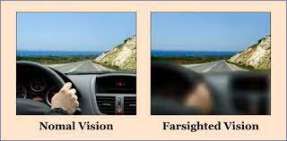 Far sight vision and normal vision