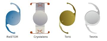 Types of Cataract lenses