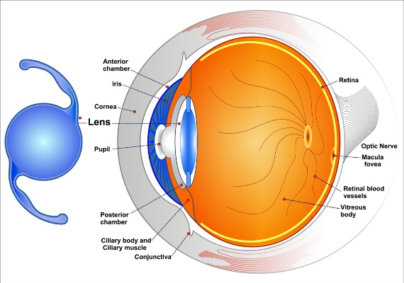 Cataract lens