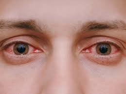 Sign and symptoms of retina