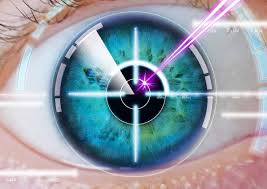 Lasik eye surgery