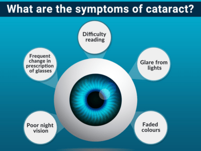 Symptom of cataract