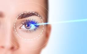 Corrective laser eye surgery