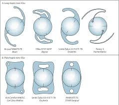 Type of toric lens for cataract surgery