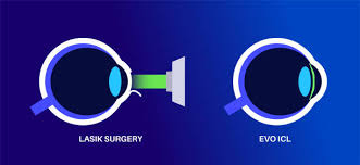 Lasik VS EVO Eye Surgery