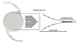 EDOP Permanent Eye Lens