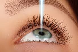 Lasik  for EyeSight Operation