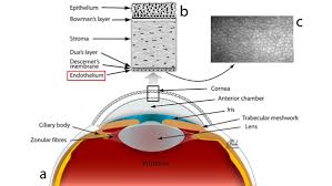 Phototherapeutic keratectomy (ptk)