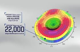 Contoura eye surgery