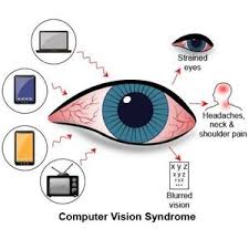 Computer Vision Syndrome