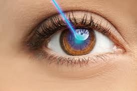 Lasik Eye Surgery
