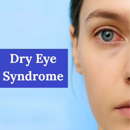 dry eye syndrome