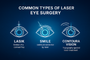 Type of laser eye treatment