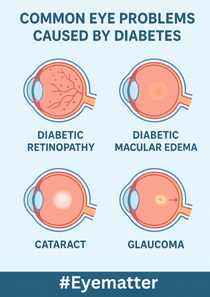 Common Eye Problems Caused by Diabetes