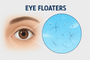 Eye Floaters