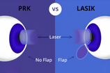 Lasik Vs PRK