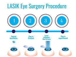Procedure of Lasi Eye Surgery