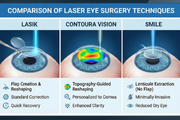 Comparison of Laser Eye Surgery Technique