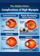 Hideen risks complicated of high myopia