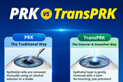 PRK Vs. TransPRK