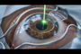 Laser Eye Surgery