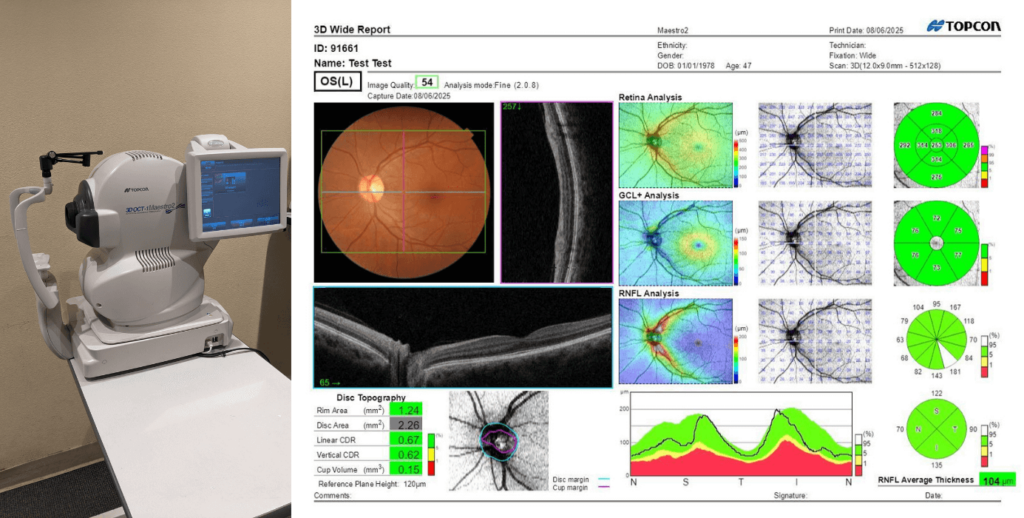 OCT vision exam
